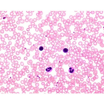 Hemacolor (R) 溶液 2 红色溶液 Hemacolor (R) 111956 2.5LMerck(默克密理博)1.11956.2500